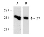 Western blot analysis of p27 expression in Jurkat (A) and NIH/3T3 (B) whole cell lysates. Antibodies used include: p27 (M-197): sc-776 (A) and p27 (N-20): sc-527 (B).