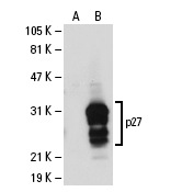p27 (M-197): sc-776. Western blot analysis of p27 expression in non-transfected: sc-110760 (A) and human p27 transfected: sc-110470 (B) 293 whole cell lysates.