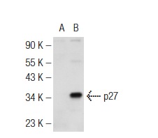 p27 (M-197): sc-776. Western blot analysis of p27 expression in non-transfected: sc-110760 (A) and human p27 transfected: sc-129376 (B) 293 whole cell lysates.