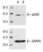 p53R2 siRNA (h): sc-36158. Western blot analysis of p53R2 expression in non-transfected control (A) and p53R2 siRNA transfected (B) HeLa cells. Blot probed with p53R2 (N-16): sc-10840. GAPDH (FL-335): sc-25778 used as specificity and loading control.