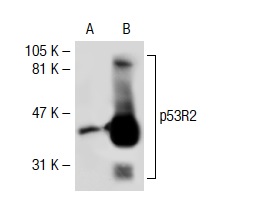 p53R2 (N-16): sc-10840. Western blot analysis of p53R2 expression in non-transfected: sc-117752 (A) and human p53R2 transfected: sc-111702 (B) 293T whole cell lysates.