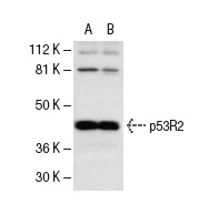 p53R2 (N-16): sc-10840. Western blot analysis of p53 phosphorylation in untreated (A) and UV irradiated (B) HeLa whole cell lysates.