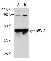 p53R2 (N-16): sc-10840. Western blot analysis of p53R2 expression in SW480 (A) and MCF7 (B) whole cell lysates.