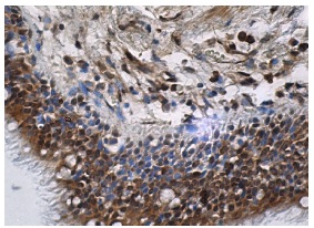 PRC1 (H-70): sc-8356. Immunoperoxidase staining of formalin fixed, paraffin-embedded human bronchus tissue showing nuclear and cytoplasmic staining of respiratory epithelial cells and interstitial cells.