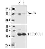 R2 siRNA (h): sc-36338. Western blot analysis of R2 expression in non-transfected control (A) and R2 siRNA transfected (B) HeLa cells. Blot probed with R2 (E-16): sc-10846. GAPDH (FL-335): sc-25778 used as specificity and loading control.