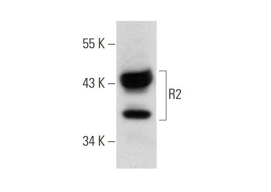 R2 (E-16): sc-10846. Western blot analysis of R2 expression in A-431 whole cell lysate.