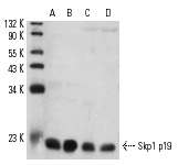 Skp1 p19 (C-20): sc-1568. Western blot analysis of Skp1 p19 expression in A-431 (A) and HeLa (B) nuclear extracts and rat brain (C) and mouse brain (D) tissue extracts.