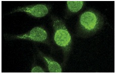 Skp1 p19 (C-20): sc-1568. Immunofluorescence staining of methanol-fixed HeLa cells showing nuclear localization.