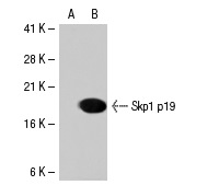 Skp1 p19 (C-20): sc-1568. Western blot analysis of Skp1 p19 expression in non-transfected: sc-117752 (A) and human Skp1 p19 transfected: sc-114049 (B) 293T whole cell lysates.