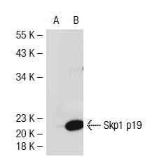 Skp1 p19 (C-20): sc-1568. Western blot analysis of Skp1 p19 expression in non-transfected: sc-117752 (A) and mouse Skp1 p19 transfected: sc-126001 (B) 293T whole cell lysates.