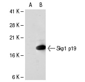 Skp1 p19 (H-163): sc-7163. Western blot analysis of Skp1 p19 expression in non-transfected: sc-117752 (A) and human Skp1 p19 transfected: sc-114049 (B) 293T whole cell lysates.