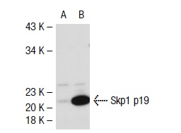 Skp1 p19 (H-163): sc-7163. Western blot analysis of Skp1 p19 expression in non-transfected: sc-117752 (A) and mouse Skp1 p19 transfected: sc-126001 (B) 293T whole cell lysates.