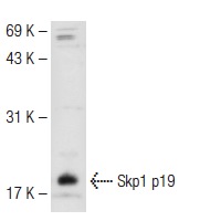 Skp1 p19 (H-163): sc-7163. Western blot analysis of Skp1 p19 expression in A-431 whole cell lysate.