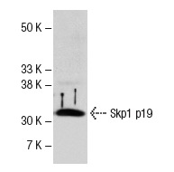 Skp1 p19 (H-163): sc-7163. Western blot analysis of Skp1 p19 expression in mouse brain tissue extract.