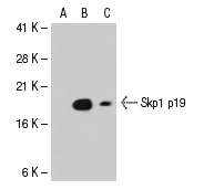 Skp1 p19 (H-6): sc-5281. Western blot analysis of Skp1 p19 expression in non-transfected: sc-117752 (A) and human Skp1 p19 transfected: sc-114049 (B) 293T whole cell lysates and A-431 nuclear extract (C).
