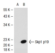 Skp1 p19 (H-6): sc-5281. Western blot analysis of Skp1 p19 expression in non-transfected: sc-117752 (A) and mouse Skp1 p19 transfected: sc-126001 (B) 293T whole cell lysates.