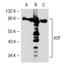 VCP (5): sc-57492. Western blot analysis of VCP expression in non-transfected 293T: sc-117752 (A), human VCP transfected 293T: sc-112114 (B) and NIH/3T3 (C) whole cell lysates.