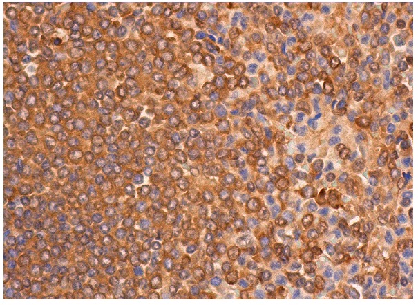 VCP (5): sc-57492. Immunoperoxidase staining of formalin fixed, paraffin-embedded human spleen tissue showing cytoplasmic staining of cells in white pulp and cells in red pulp.