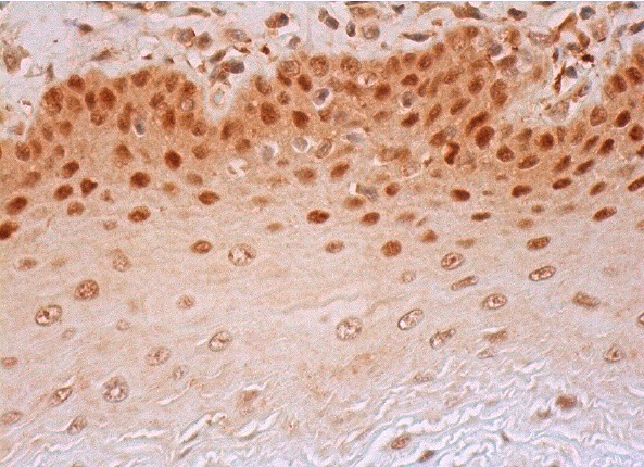 WHIP (G-2): sc-377402. Immunoperoxidase staining of formalin fixed, paraffin-embedded human esophagus tissue showing nuclear and cytoplasmic staining of squamous epithelial cells.
