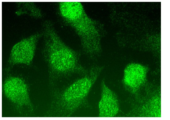 WHIP (G-2): sc-377402. Immunofluorescence staining of methanol-fixed HeLa cells showing nuclear and cytoplasmic localization.