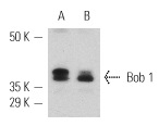 Bob 1 (C-20): sc-955. Western blot analysis of Bob 1 expression in MM-142 (A) and MM-142 phorbol ester-induced (B) nuclear extracts.