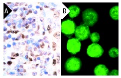 Bob 1 (C-20): sc-955. Immunoperoxidase staining of formalin-fixed, paraffin-embedded normal human tonsil showing nuclear staining (A). Immunofluorescence staining of methanol-fixed MM-142 cells showing nuclear localization (B).