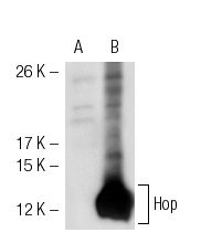 Hop (FL-73): sc-30216. Western blot analysis of Hop expression in non-transfected: sc-117752 (A) and mouse Hop transfected: sc-120878 (B) 293T whole cell lysates.