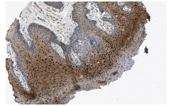 Hop (FL-73): sc-30216. Immunoperoxidase staining of formalin fixed, paraffin-embedded human Oral mucosa tissue showing nuclear and cytoplasmic staining of cells in squamous epithelial cells at low magnification. Kindly provided by The Swedish Human Protein Atlas (HPA) program.