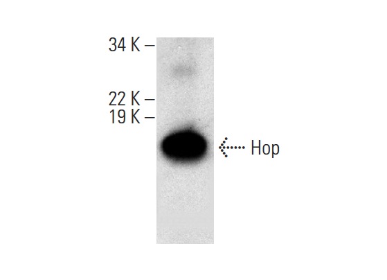 Hop (FL-73): sc-30216. Western blot analysis of Hop expression in human placenta tissue extract.