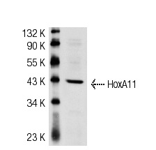HoxA11 (N-15): sc-48542. Western blot analysis of HoxA11 expression in mouse prostate tissue extract.