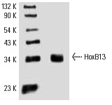 HoxB13 (F-9): sc-28333. Western blot analysis of HoxB13 expression in LNCaP whole cell lysate.