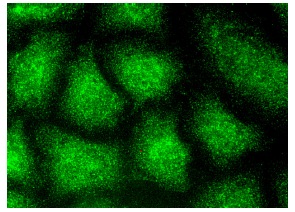 HoxB13 (F-9): sc-28333. Immunofluorescence staining of methanol-fixed HeLa cells showing nuclear and cytoplasmic localization.