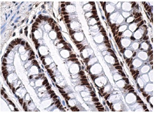 HoxB13 (F-9): sc-28333. Immunoperoxidase staining of formalin fixed, paraffin-embedded human rectum tissue showing nuclear staining of glandular cells.