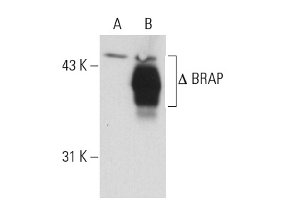 BRAP (D-5): sc-166012. Western blot analysis of BRAP expression in non-transfected: sc-117752 (A) and truncated mouse BRAP transfected: sc-118840 (B) 293T whole cell lysates.