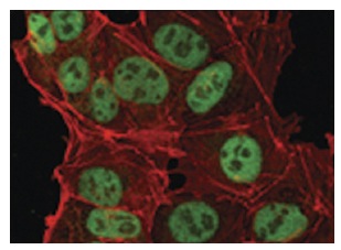 Nanog (1E6C4): sc-293121. Immunofluorescence staining of NTERA-2 cells. Confocal microscopy showing cells labeled by anti-Nanog (1E6C4) (green) and Actin filaments labeled with DY-554 phalloidin (red).