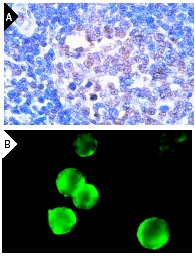 Oct-1 (C-21): sc-232. Immunoperoxidase staining of formalin-fixed, paraffin-embedded normal human tonsil (A) and immunofluorescence staining of methanol-fixed Jurkat cells (B) showing nuclear localization.