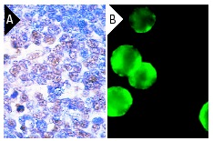 Oct-1 (C-21): sc-232. Immunoperoxidase staining of formalin-fixed, paraffin-embedded normal human tonsil (A) and immunofluorescence staining of methanol-fixed Jurkat cells (B) showing nuclear localization.