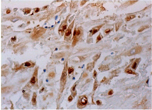 Oct-1 (12F11): sc-8024. Immunoperoxidase staining of formalin fixed, paraffin-embedded human placenta tissue showing nuclear and cytoplasmic staining of decidual cells.