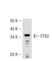OTX2 (Y-23): sc-133873. Western blot analysis of OTX2 expression in Hep G2 nuclear extract.