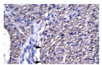 OTX2 (Y-23): sc-133873. Immunoperoxidase staining of formalin-fixed, paraffin-embedded human heart tissue showing membrane localization.