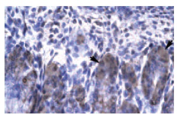 OTX2 (Y-23): sc-133873. Immunoperoxidase staining of formalin-fixed, paraffin-embedded human stomach tissue showing cytoplasmic localization.