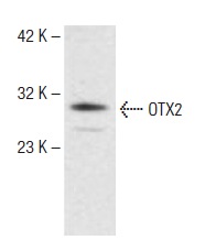 OTX2 (Y-23): sc-133873. Western blot analysis of OTX2 expression in Jurkat whole cell lysate.