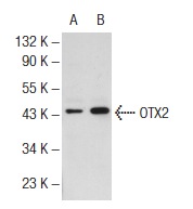 OTX2 (Y-23): sc-133873. Western blot analysis of OTX2 expression in non-transfected: sc-117752 (A) and human OTX2 transfected: sc-172552 (B) 293T whole cell lysates.