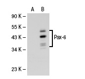 Pax-6 (AD2.38): sc-32766. Western blot analysis of Pax-6 expression in non-transfected: sc-110760 (A) and human Pax-6 transfected: sc-113085 (B) 293 whole cell lysates.