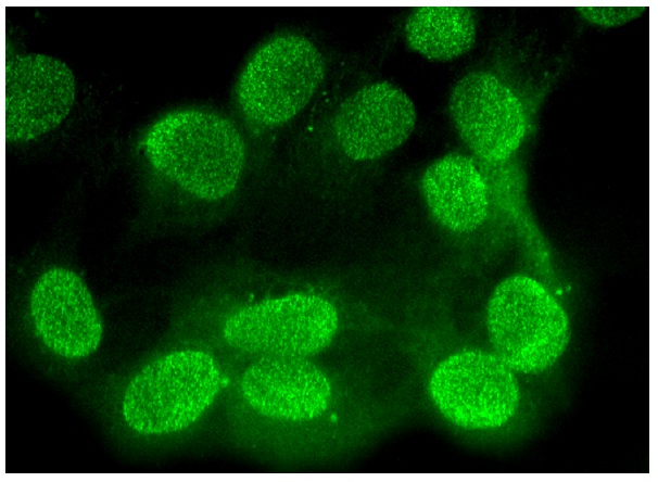 Pbx 1/2/3/4 (F-3): sc-28313. Immunofluorescence staining of formalin-fixed HepG2 cells showing nuclear localization.