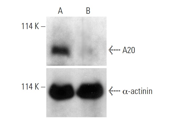 A20 CRISPR/Cas9 KO Plasmid (h): sc-400447. Western blot analysis of human A20 expression in empty vector control (A) and A20 CRISPR/Cas9 KO Plasmid transfected (B) HEK293T whole cell lysates. Blot probed with A20 (A-12): sc-166692. β-actinin (H-2): sc-17829 used as specificity and loading control.