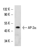 AP-2α (B-11): sc-55485. Western blot analysis of AP-2α expression in HeLa whole cell lysate.