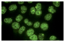 AP-2α (B-11): sc-55485. Immunofluorescence staining of methanol-fixed HeLa cells showing nuclear localization.