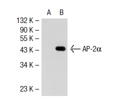 AP-2α (B-11): sc-55485. Western blot analysis of AP-2α expression in non-transfected: sc-117752 (A) and mouse AP-2α transfected: sc-118446 (B) 293T whole cell lysates.