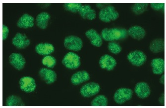 AP-2α (B-11): sc-55485. Immunofluorescence staining of methanol-fixed HeLa cells showing nuclear localization.